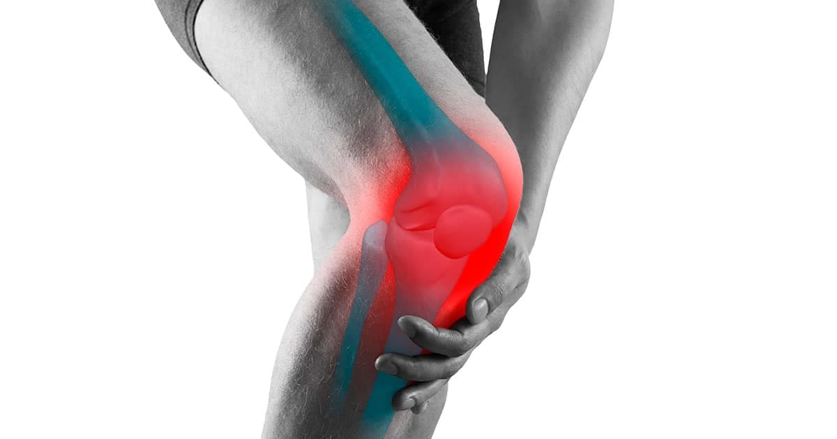Artrosis de rodilla, principales causas, tratamientos y que puedes hacer para prevenir