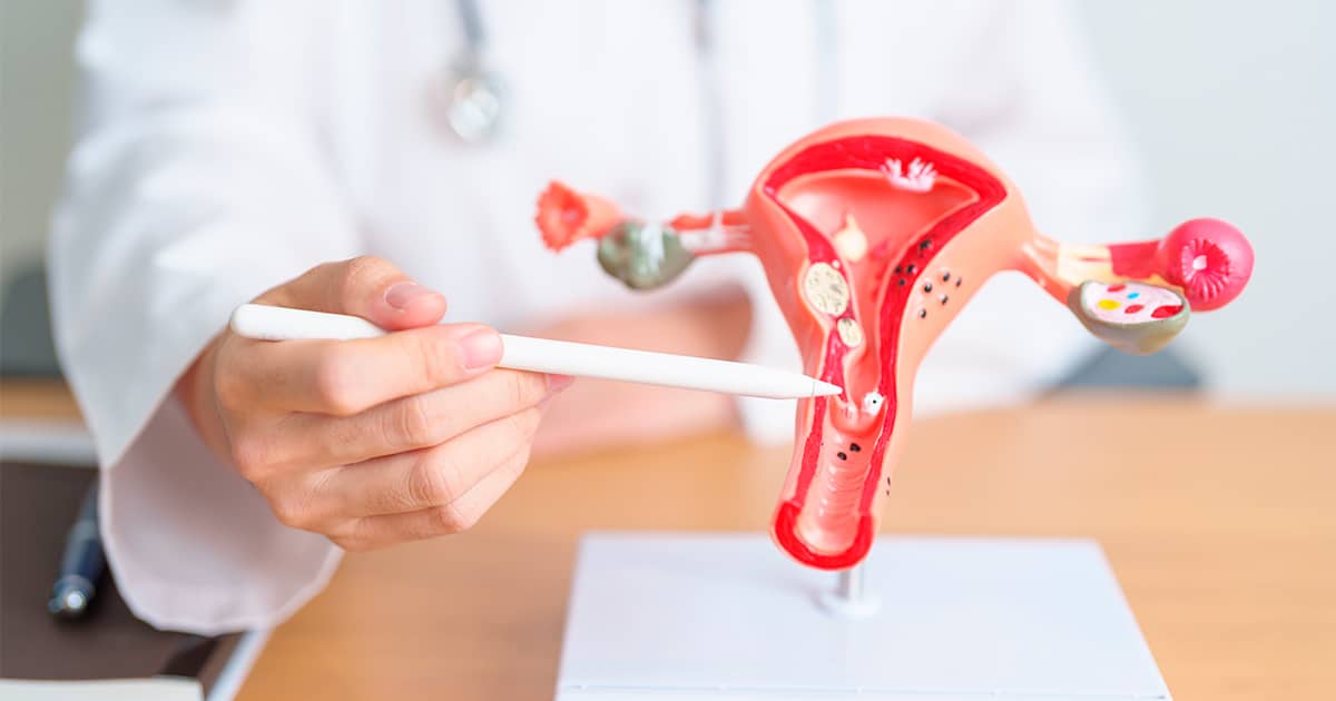 La endometriosis compleja afecta al 10% de las mujeres menstruales